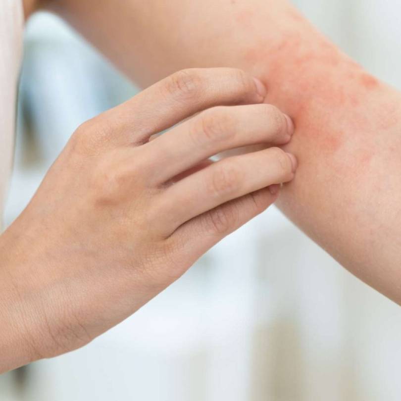 Dry, Irritated, Sensitive Skin