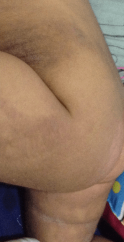 Claire D. testimonial