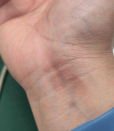 Jasmine R. testimonial