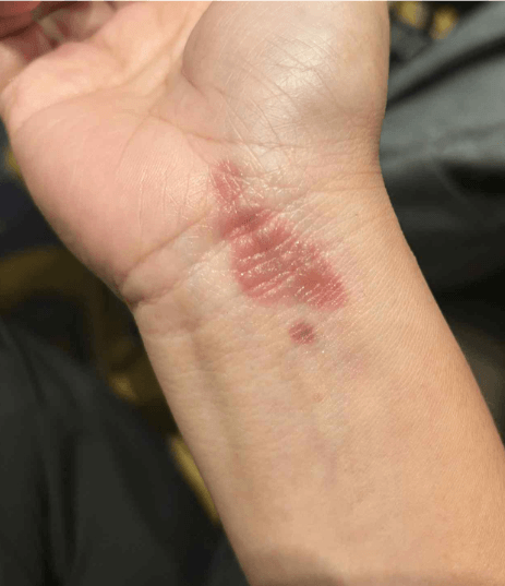 Jasmine R. testimonial