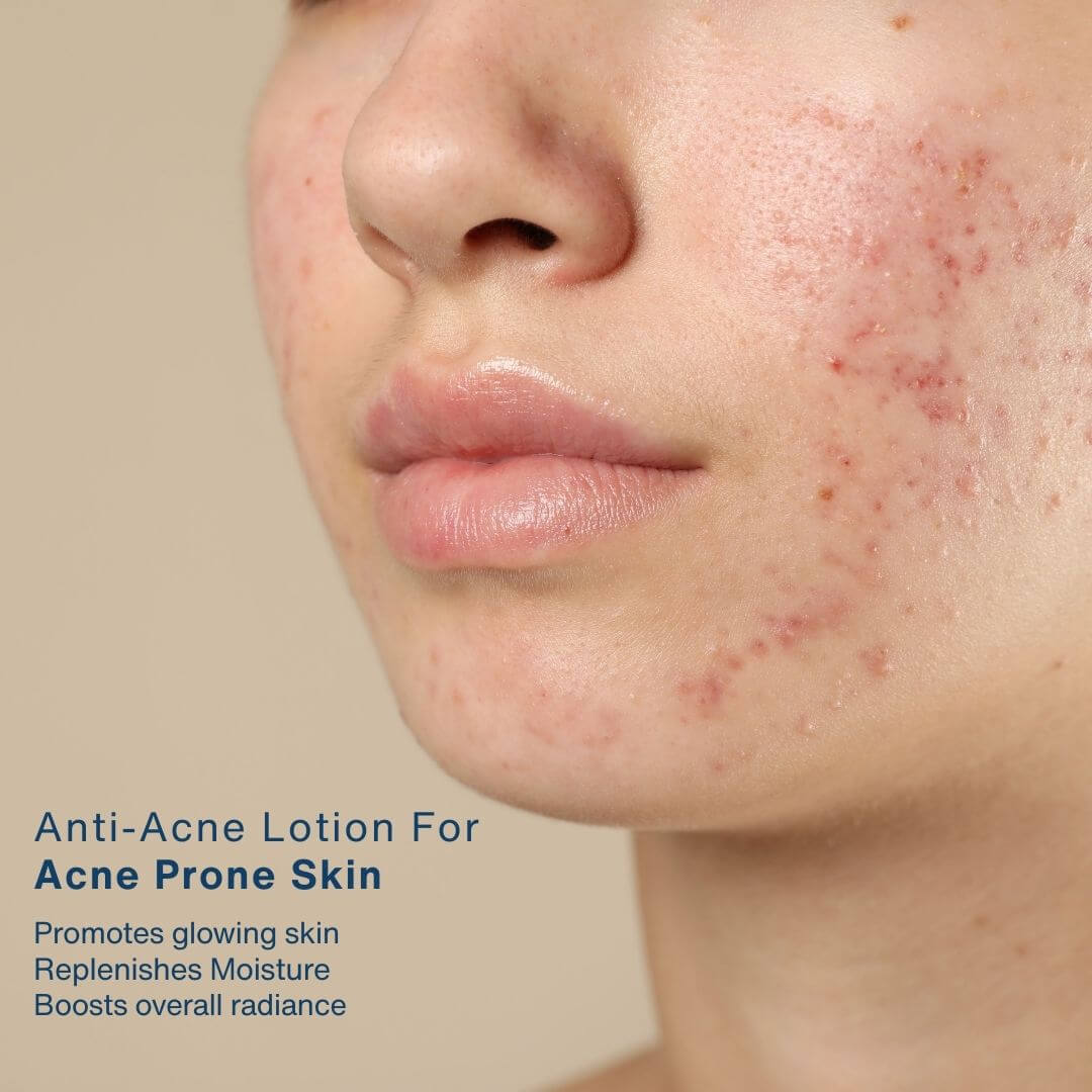 Salyzap Lotion (Night Time)