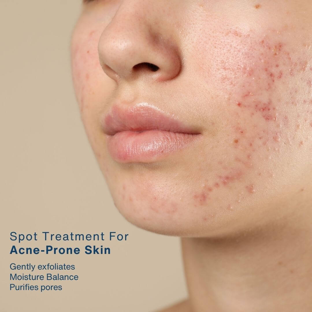 Salyzap Gel (Day Time)