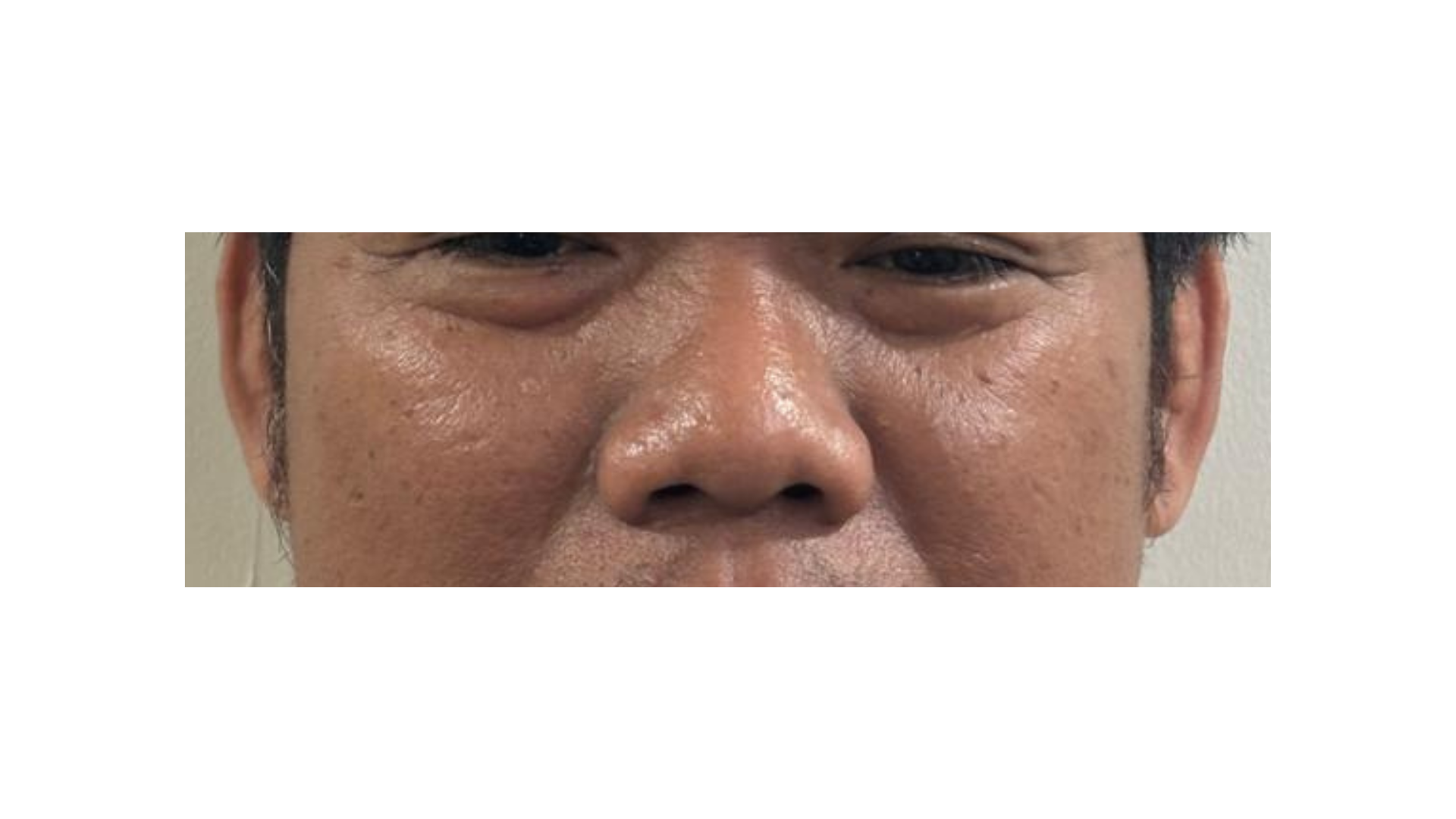 Anti Aging Cream Documentation (2) Anti Aging Cream Documentation (2)