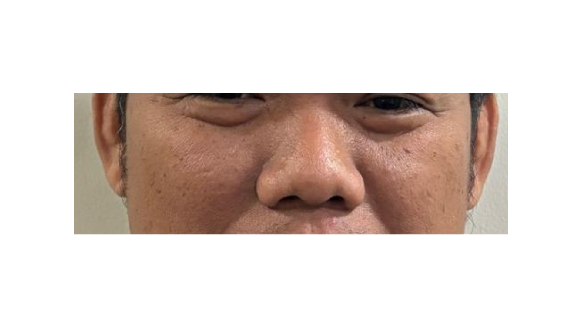 Anti Aging Cream Documentation (3) Anti Aging Cream Documentation (3)