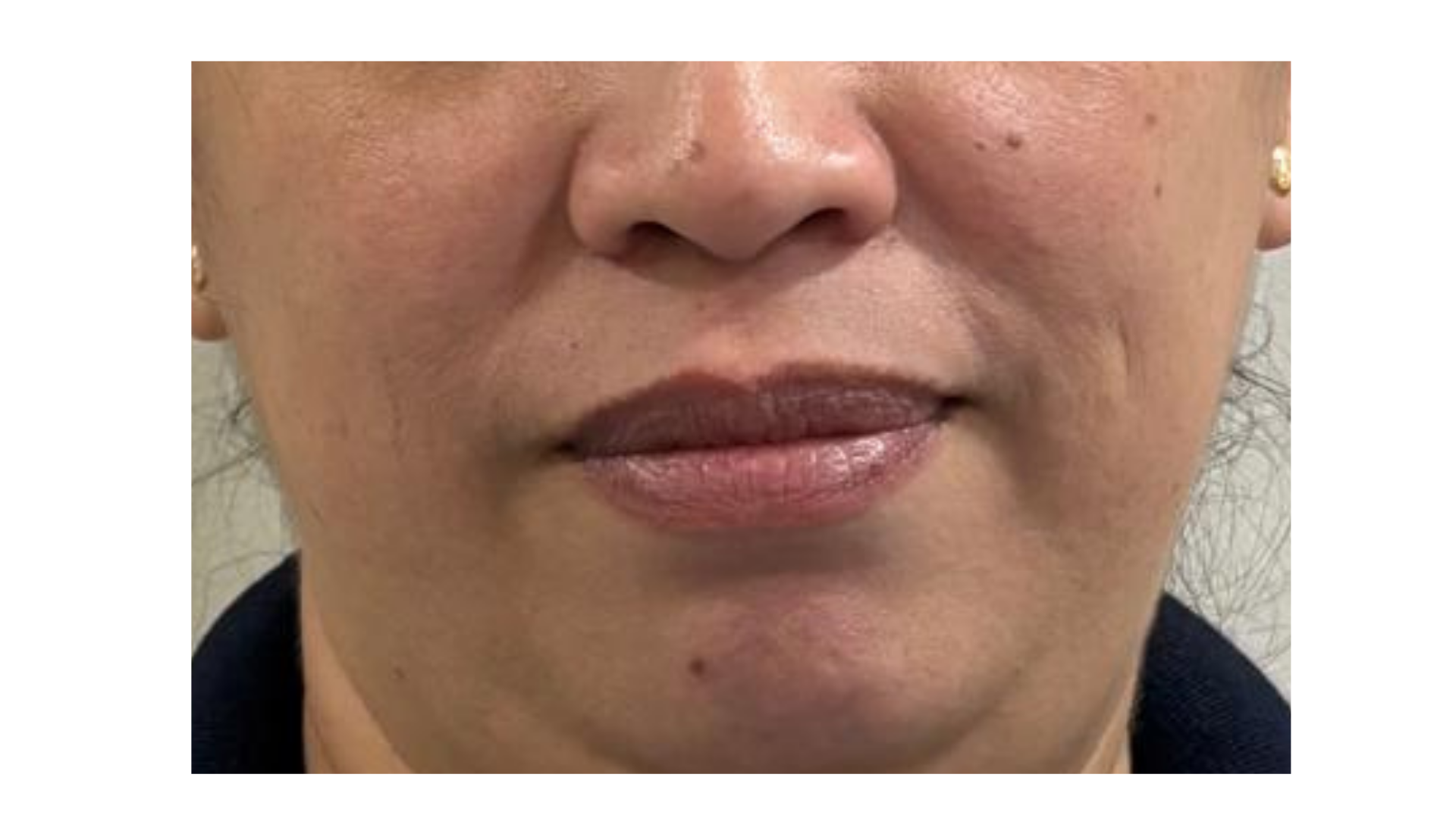 Anti Aging Cream Documentation (6) Anti Aging Cream Documentation (6)