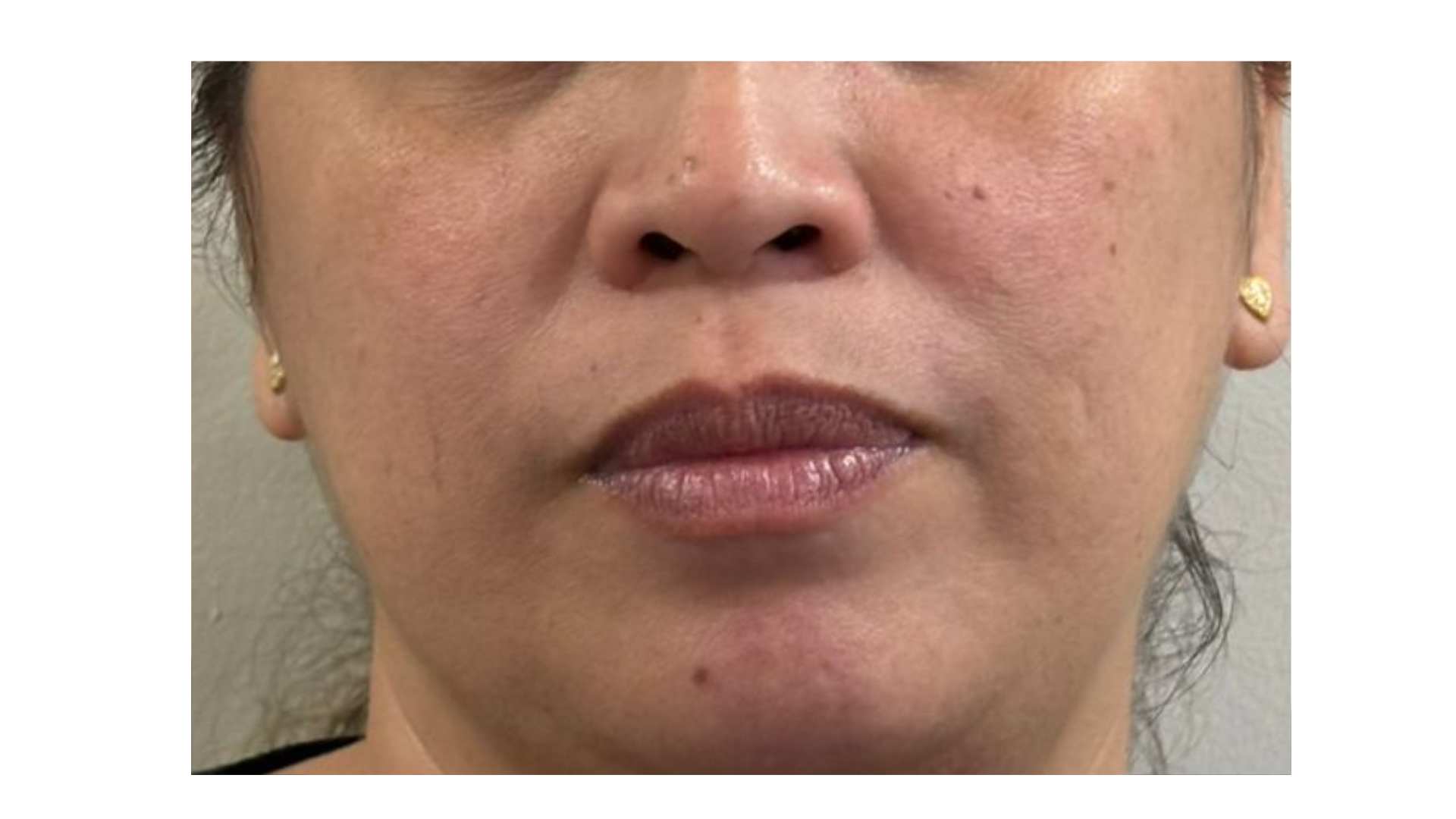Anti Aging Cream Documentation (7) Anti Aging Cream Documentation (7)
